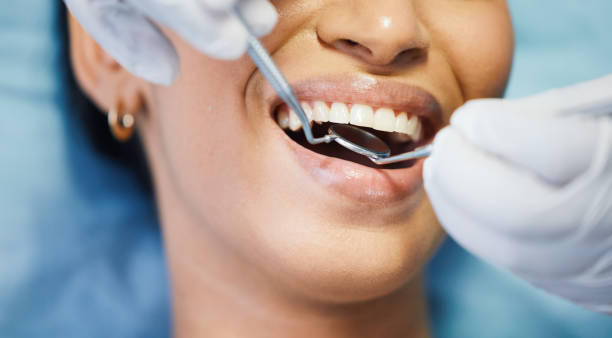 Best Emergency Broken Tooth Repair in Rosemount, OH